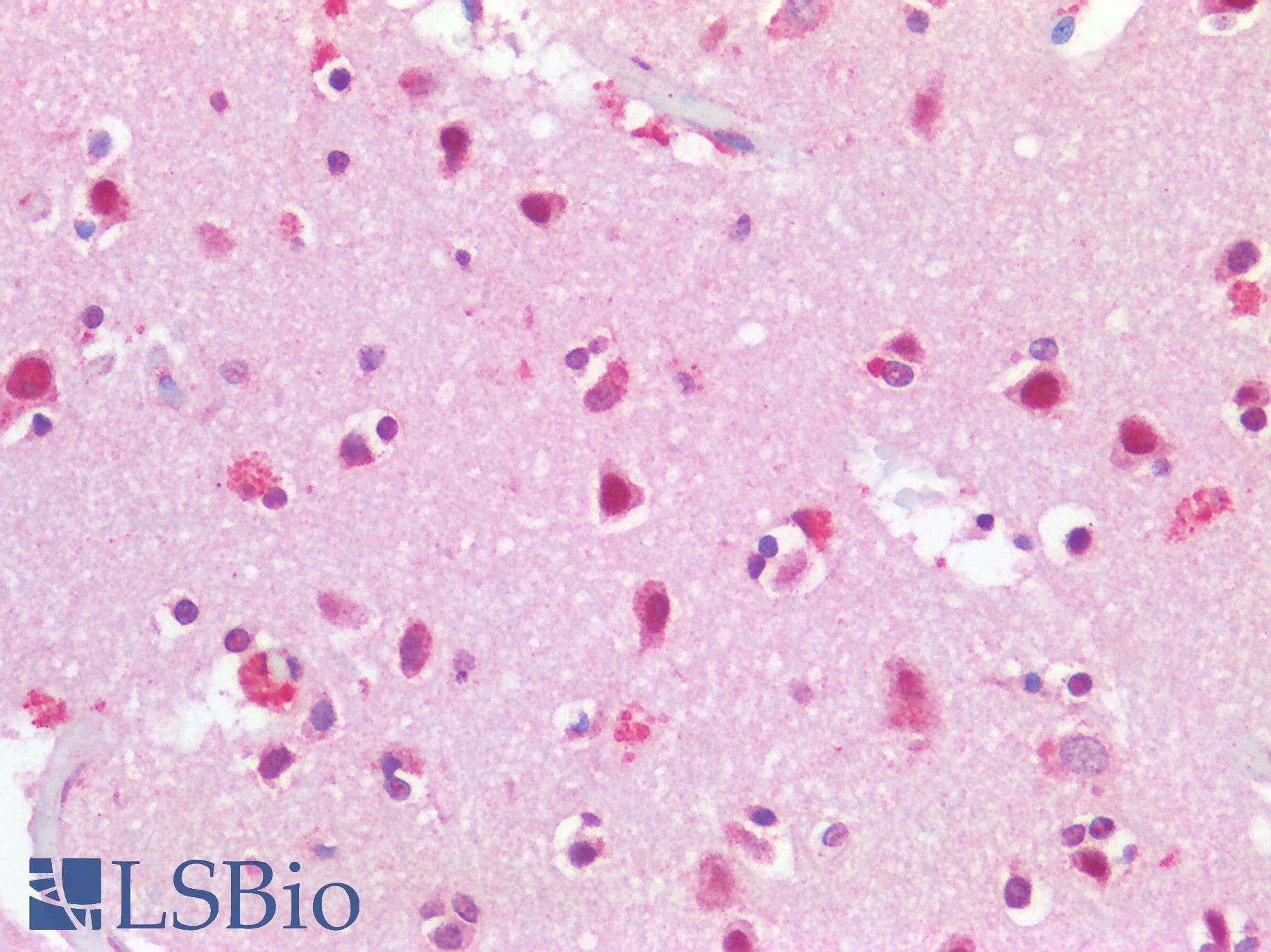 IHC-plus™ Polyclonal Goat anti-Human TP53BP1 / 53BP1 Antibody (aa350-400, IHC)