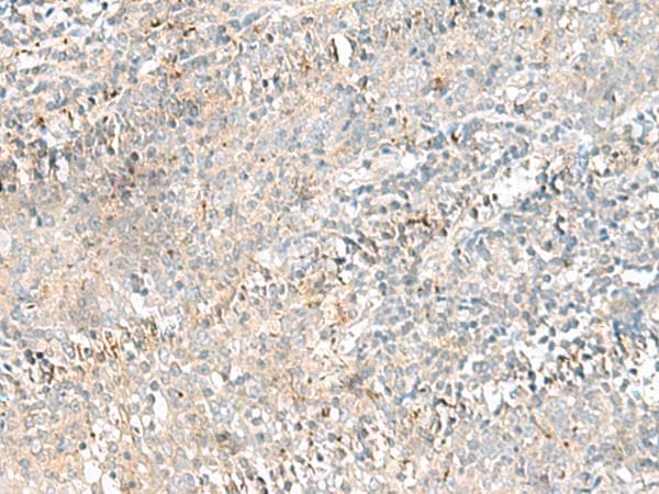 CTRB1 / Chymotrypsinogen B1 Antibody