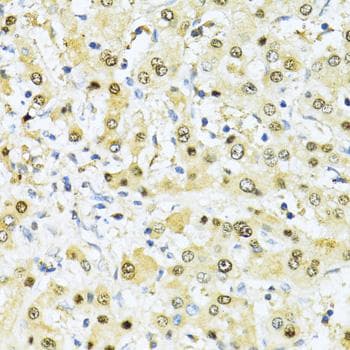 Polyclonal Rabbit anti-Human ITGB3BP Antibody (IHC)