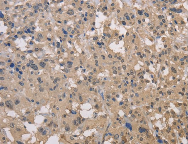 DRG1 / NEDD3 Antibody