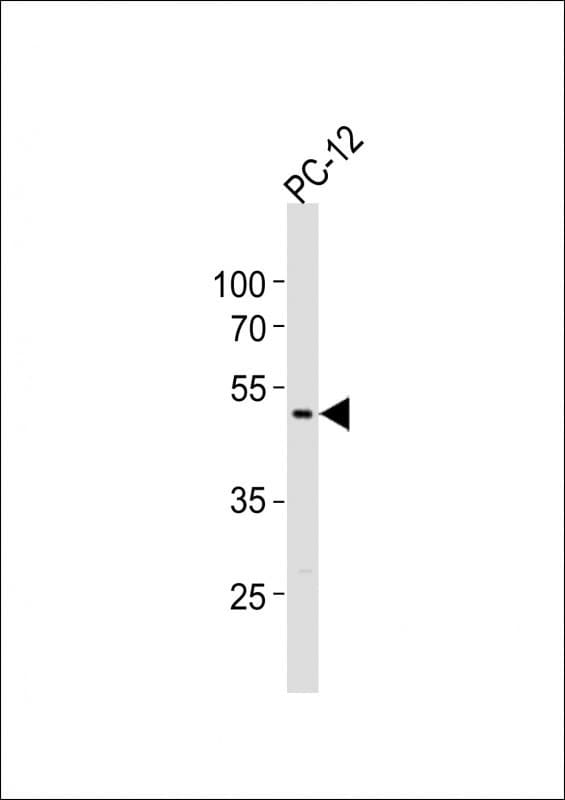Polyclonal Rabbit anti-Human PIP4K2A / PIPK Antibody (aa365-400, WB)