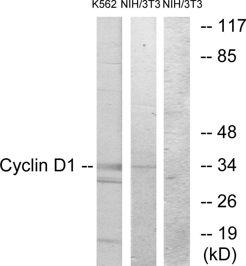 CCND1 / Cyclin D1 Antibody (p90)