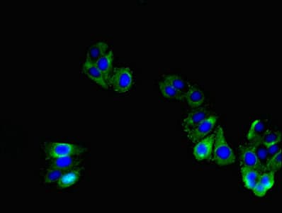 TNMD / Tenomodulin Antibody