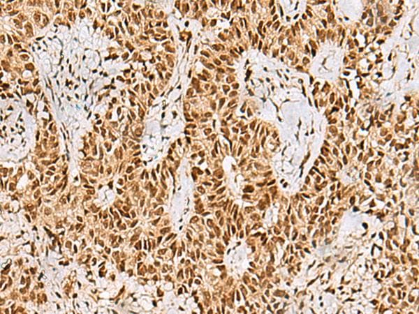 Polyclonal Rabbit anti-Human PHF5A / INI Antibody (IHC, WB)