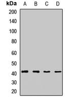 DLK1 / Pref-1 Antibody