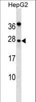 NOG / Noggin Antibody (aa84-111)