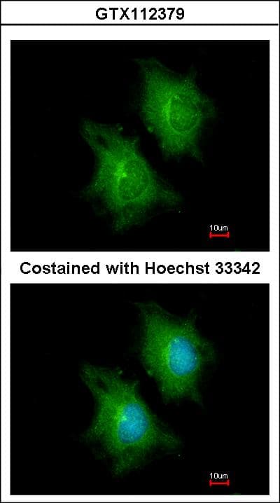 ACLY / ATP Citrate Lyase Antibody