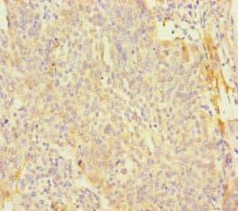 Polyclonal Rabbit anti-Human PAGE2B Antibody