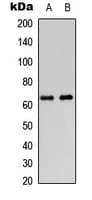 DGKE / DGK Epsilon Antibody (Internal)