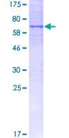 Human EXOSC3 Protein (Recombinant GST)