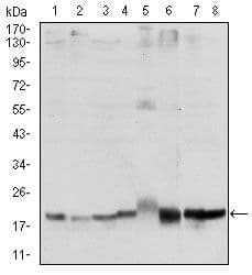 SKP1 Antibody (clone 4E+11)