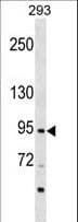 ZNF341 Antibody (aa292-321)