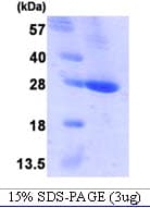 Human BCL2 / Bcl-2 Protein (Recombinant His)