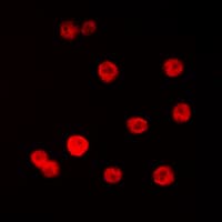 SP1 Antibody (Internal)