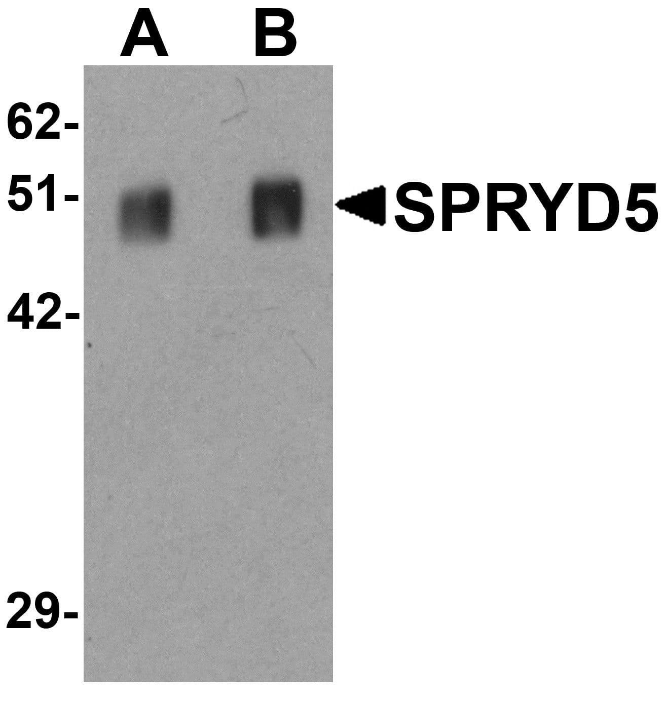 IHC-plus™ SPRYD5 Antibody