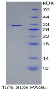 Human VCAN / Versican Protein (Recombinant His, N-Terminal)