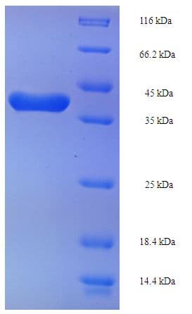 Human TAGLN2 / Transgelin 2 Protein (Recombinant His-SUMO)