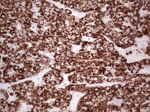 Monoclonal Mouse anti-Human ABAT Antibody (clone OTI1F10, aa29-323, IHC, WB)