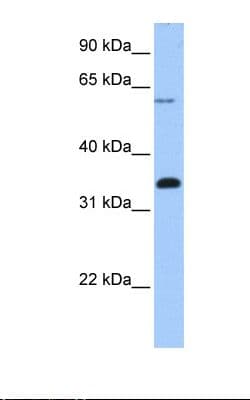 FBXO16 Antibody (aa194-243)