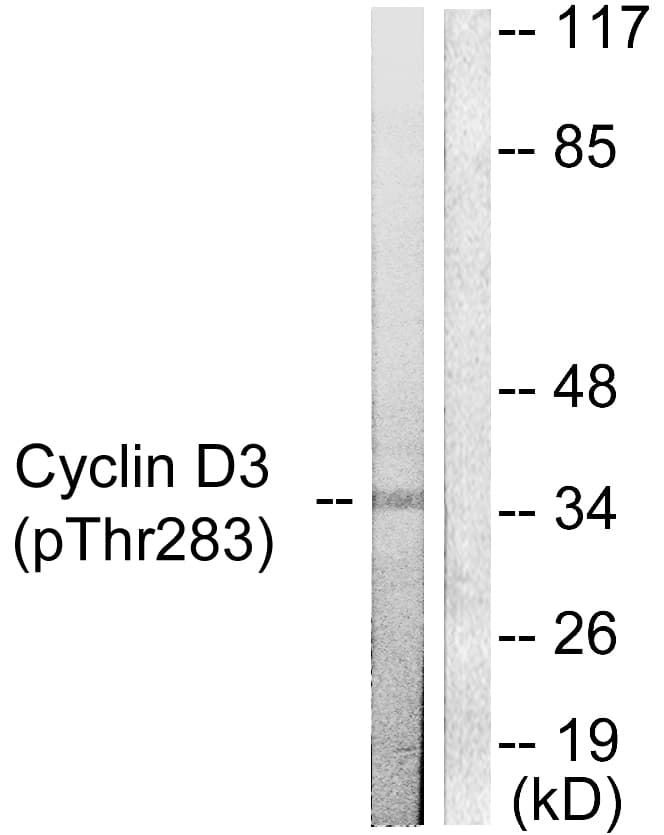 CCND3 / Cyclin D3 Antibody (phospho-Thr283)