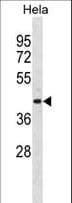 ADPRH / ARH1 Antibody (aa306-334)