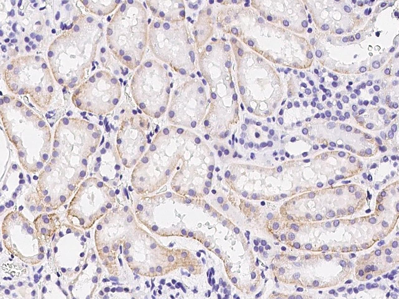 Monoclonal Mouse anti-Human INSR / Insulin Receptor Antibody (clone 07, Preservative Free, IHC)
