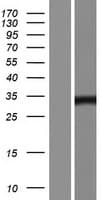 Human JMJD8 Protein (Over-Expression Lysate Myc-DDK (Flag))