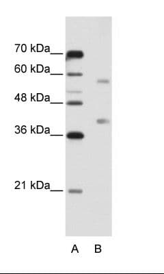 HNRNPA3 / HnRNP A3 Antibody (N-Terminus)