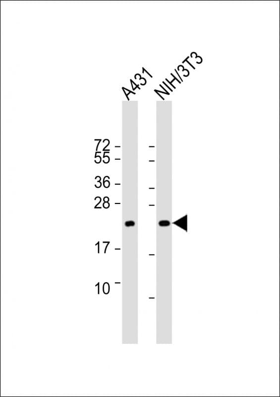 TC21 / RRAS2 Antibody (clone 1578CT130.349.47.14)