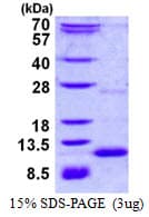 Mouse CXCL3 / GRO Gamma Protein (Recombinant His)