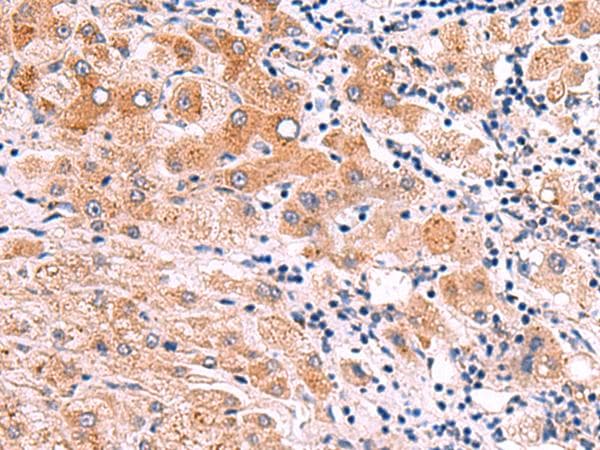 ITGA11 / Integrin Alpha 11 Antibody