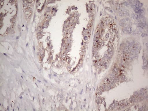CTDSP2 Antibody (clone OTI7F5)