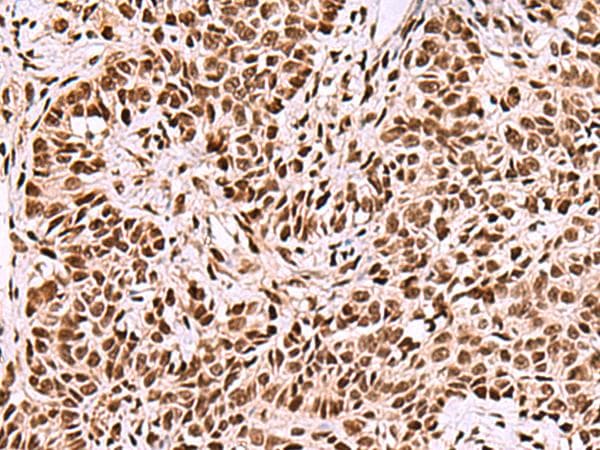Polyclonal Rabbit anti-Human FOXK2 / ILF Antibody (IHC, WB)