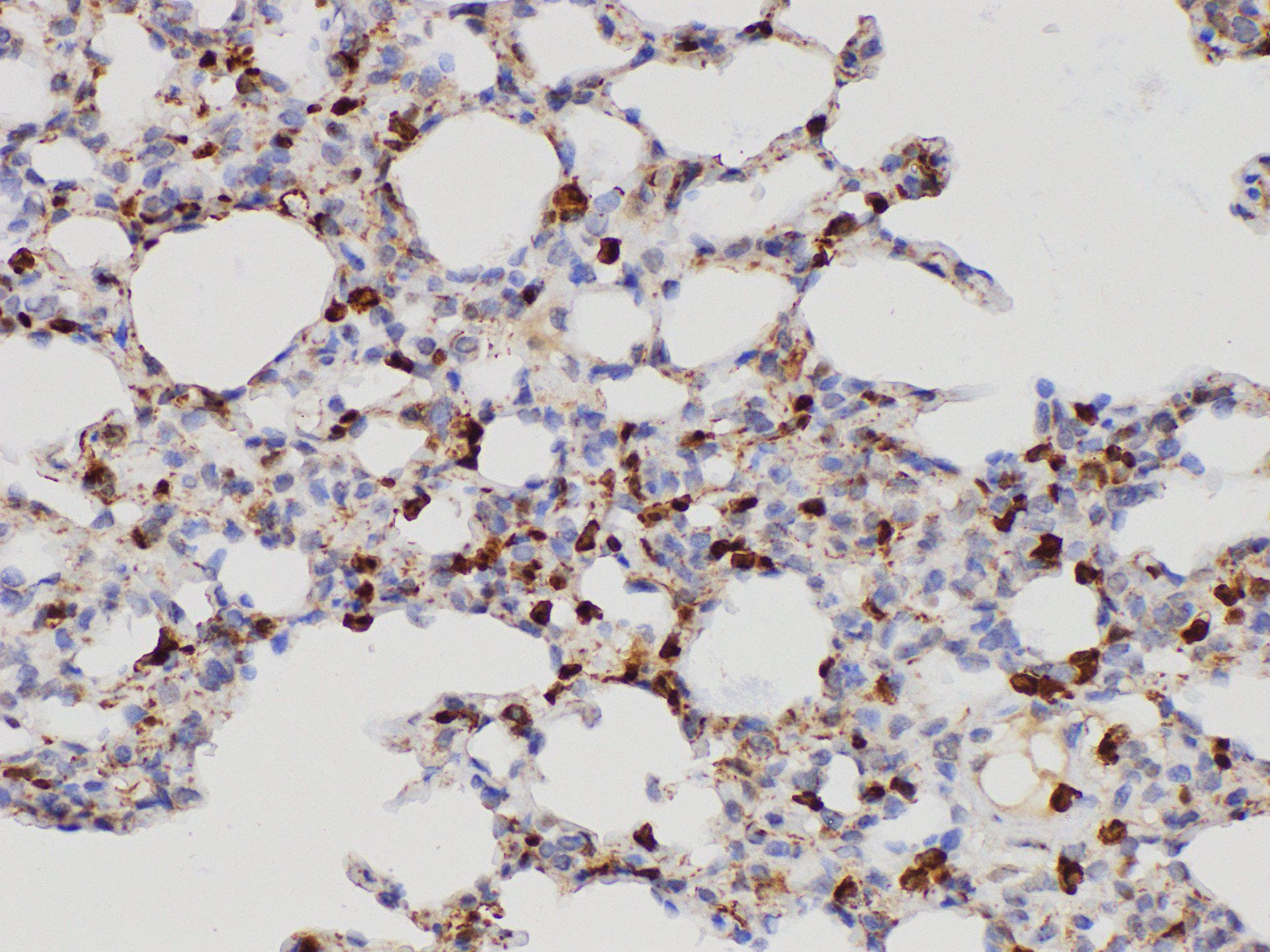 S100A4 / FSP1 Antibody