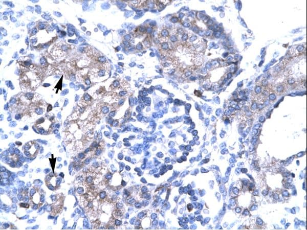 TBX19 / TPIT Antibody (N-Terminus, HRP)