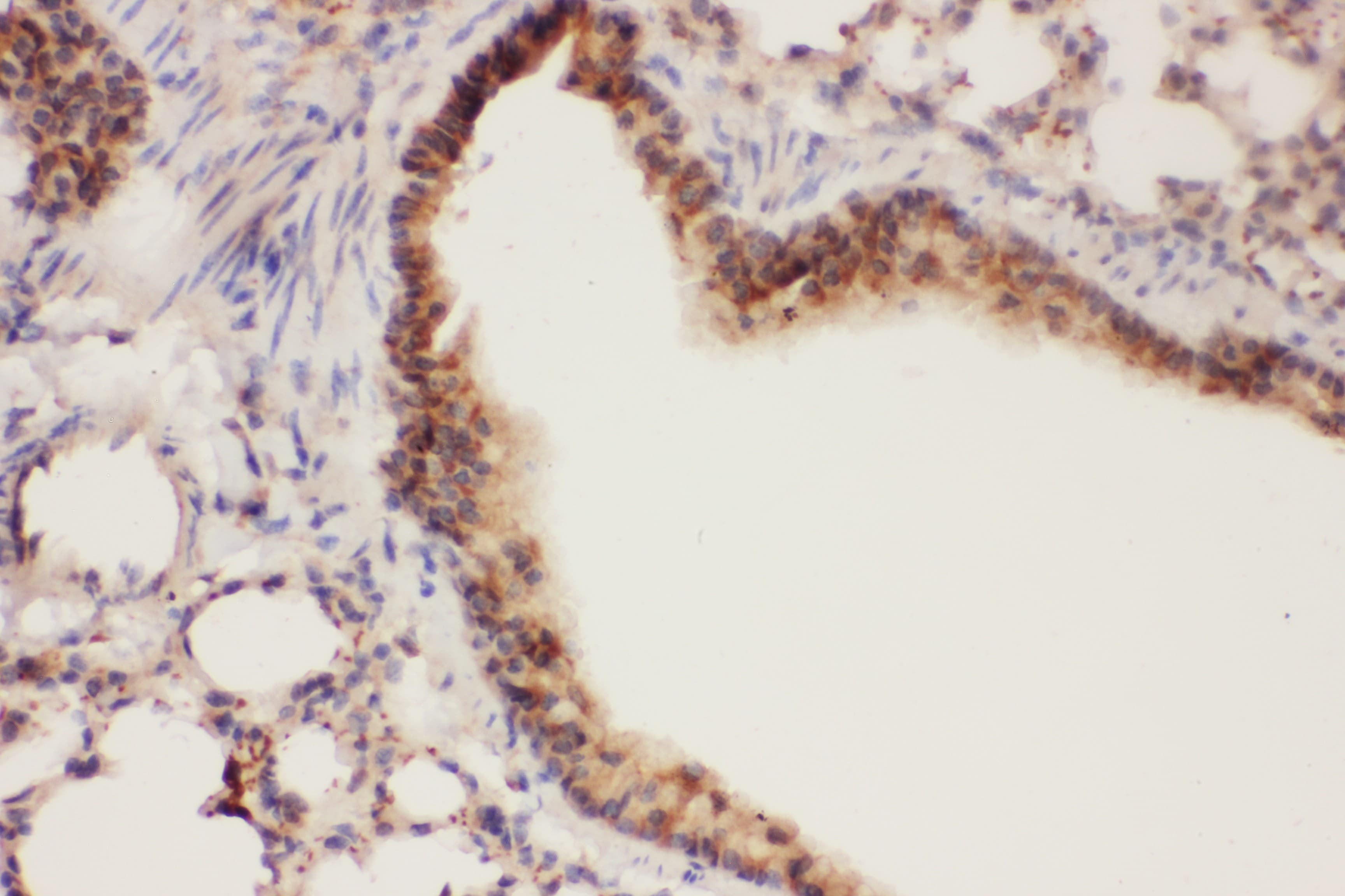 Polyclonal Rabbit anti-Human ALOX15 / 15-Lipoxygenase Antibody (aa2-337, IHC, WB)