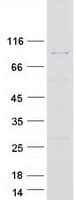 Human ACAD11 Protein (Recombinant Myc-DDK (Flag))