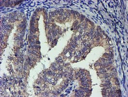 TCP11L2 Antibody (clone OTI2H4)