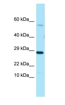 PDE7A Antibody (C-Terminus)