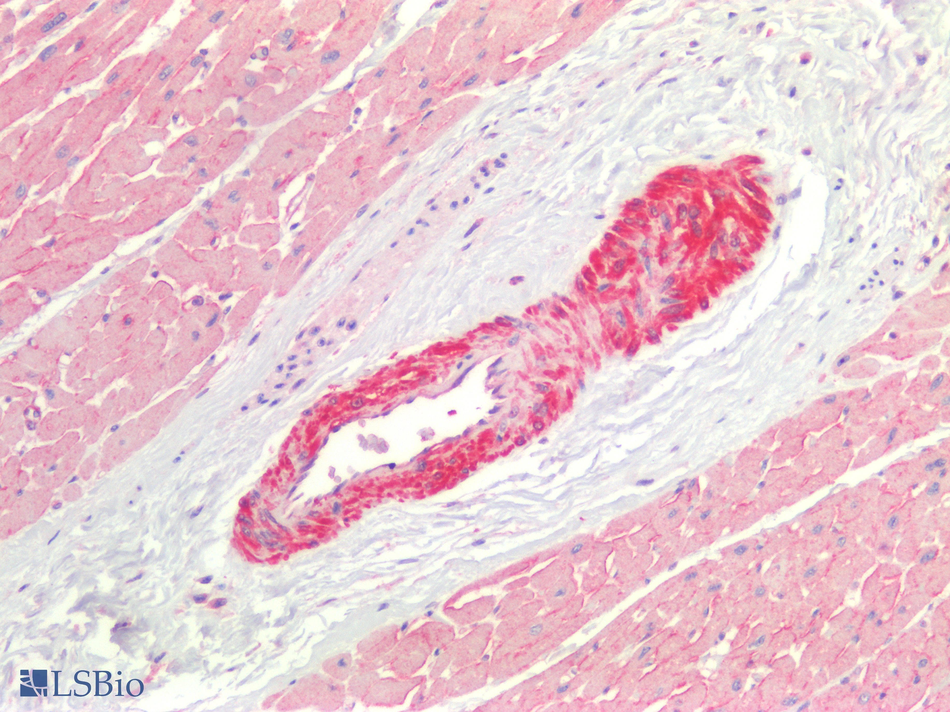 PathPlus™ PTGS2 / COX2 / COX-2 Antibody