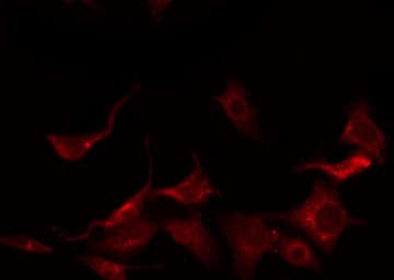 Polyclonal Rabbit anti-Human FGFR1 / FGF Receptor 1 Antibody (phospho-Tyr654, IF, WB)