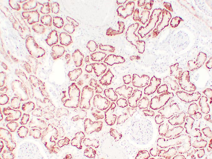 VHL / Von Hippel Lindau Antibody (clone ABT-PVHL)