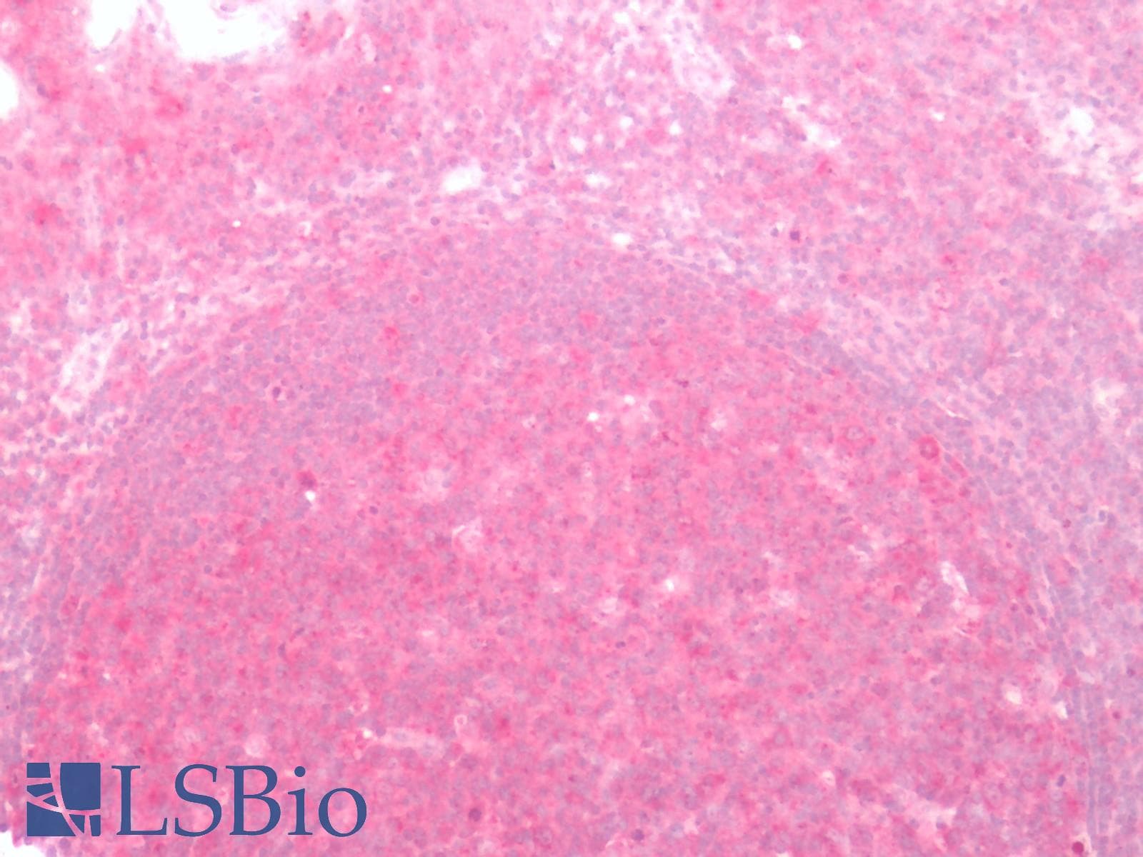 IHC-plus™ FZD2 / Frizzled 2 Antibody (Extracellular Domain)
