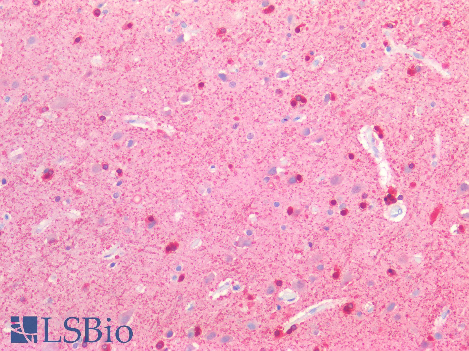 IHC-plus™ Polyclonal Rabbit anti-Human SLC6A3 / Dopamine Transporter Antibody (IHC)
