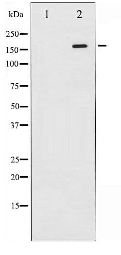 MAP3K5 / ASK1 Antibody (phospho-Ser966)