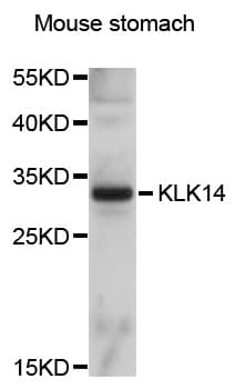 KLK14 / Kallikrein 14 Antibody