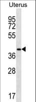Polyclonal Rabbit anti-Human OR2V2 Antibody (aa245-273, WB)