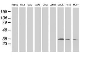 SIRT5 / Sirtuin 5 Antibody (clone OTI 1G9)