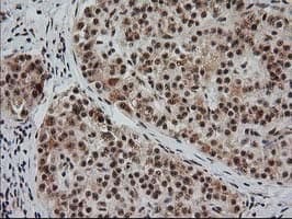 Monoclonal Mouse anti-Human MGLL / Monoacylglycerol Lipase Antibody (clone OTI1H1, IHC, IF, WB)