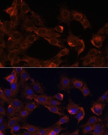 NRP1 / Neuropilin 1 Antibody